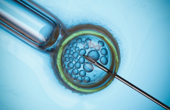 In Vitro Fertilization (IVF)